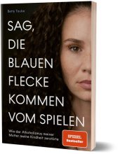 Cover: Sag, die blauen Flecke kommen vom Spielen